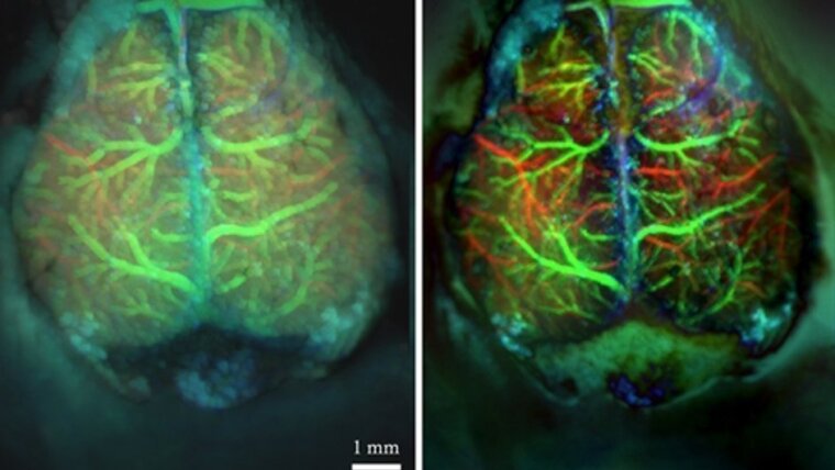 Brain images before (a) and after (b) the application of a time-space Fourier Kappa-Omega filtering approach.